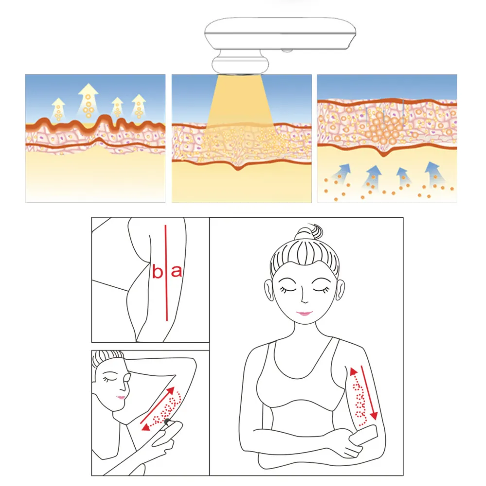 Femvy Face and Body Skin Tightening Radio Frequency Device