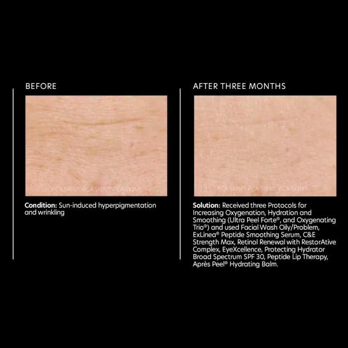 PCA Skin Exlinea Peptide Smoothing Serum