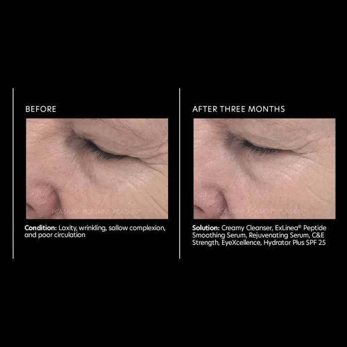PCA Skin Exlinea Peptide Smoothing Serum