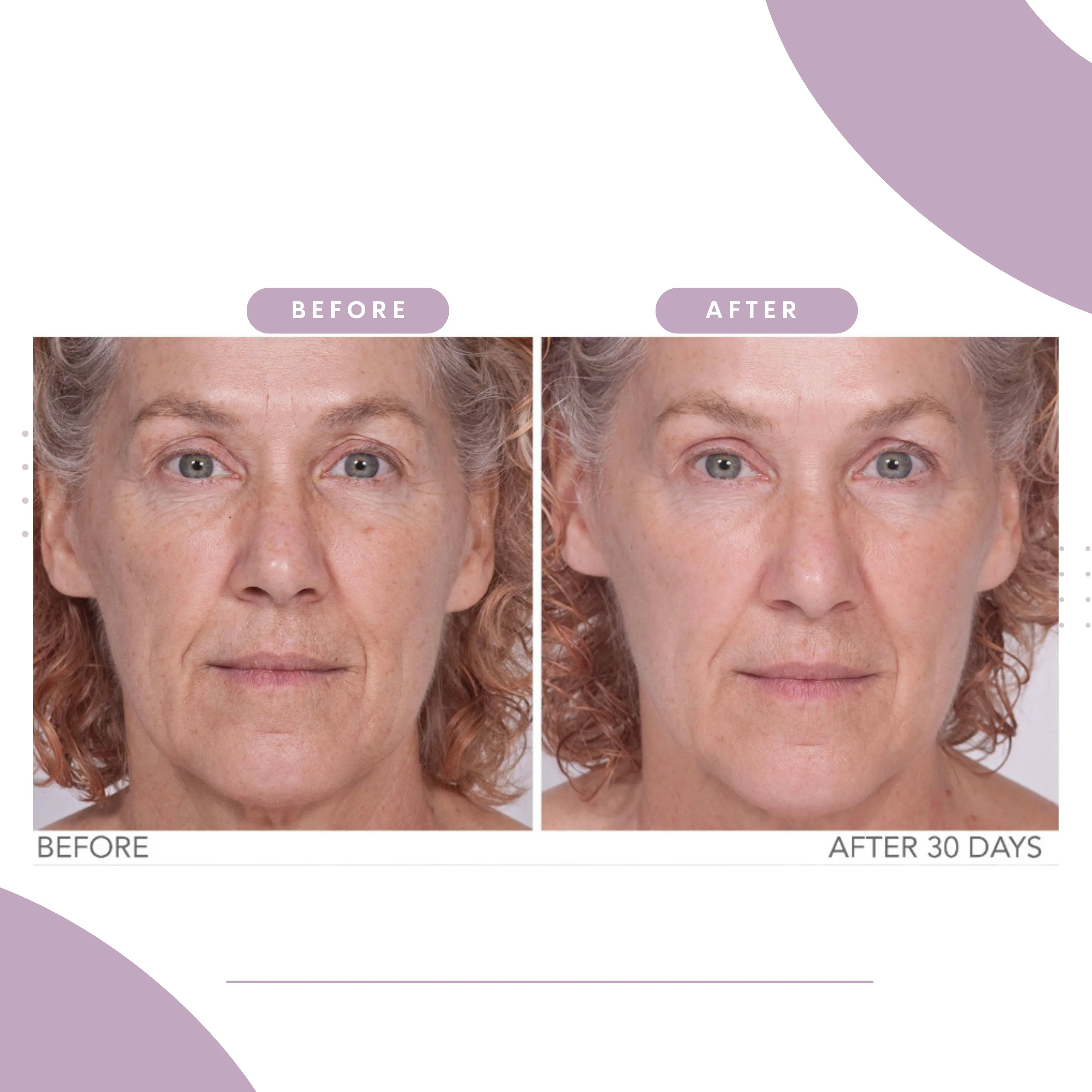 Reverse Lift Serum