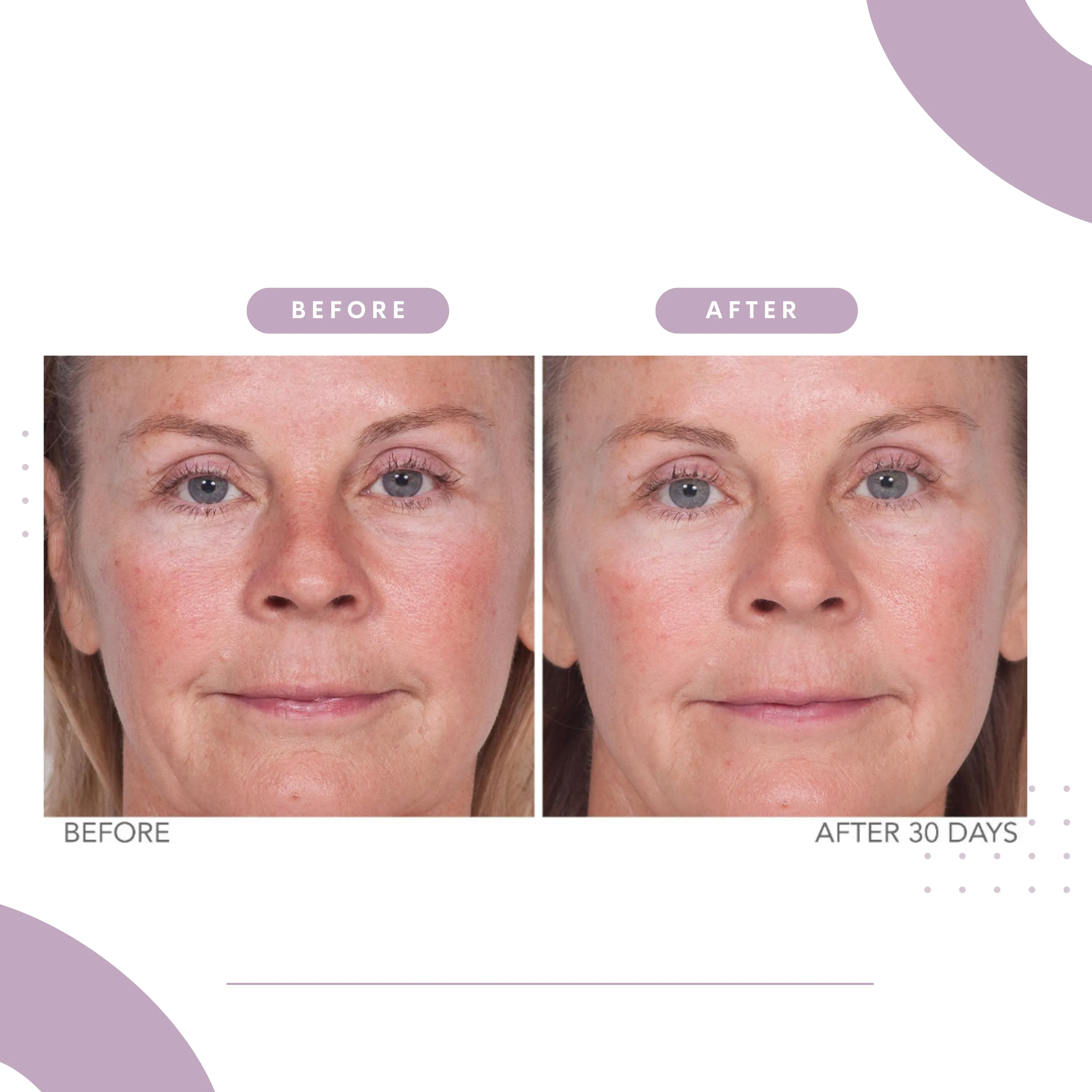 Reverse Lift Serum